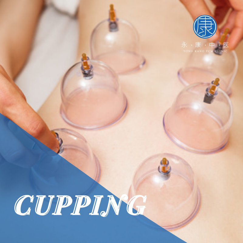 TCM Cupping Singapore | Stress, Pain, & Inflammation Relief