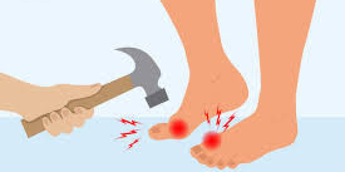 Penyakit Gout: Punca, Simptom, Makanan Pantang & Cara Turunkan Asid Urik Secara Berkesan