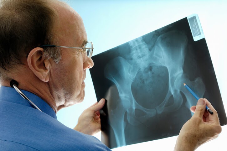 Why Orthopedic Pharma is Booming and the Role of Ortho PCD Companies