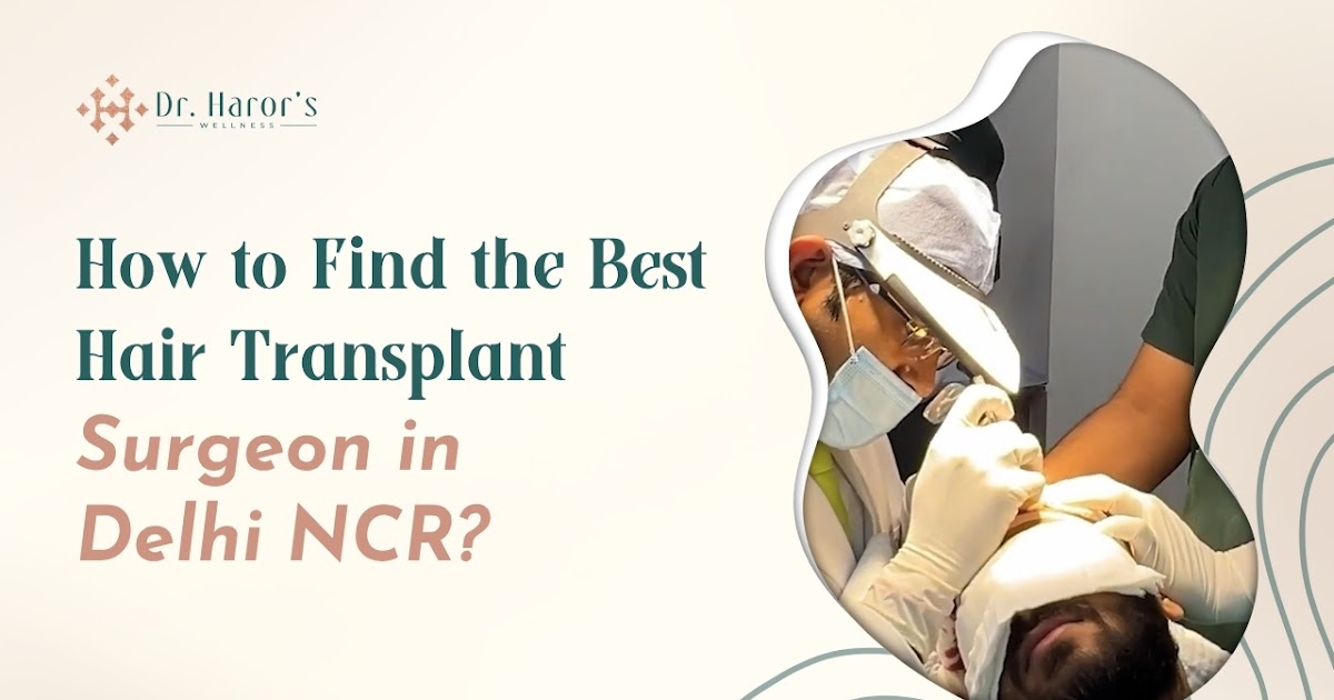 How to Find the Best Hair Transplant Surgeon in Delhi NCR?