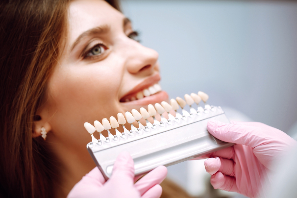 Best Veneer Materials for a Natural and Long Lasting Smile