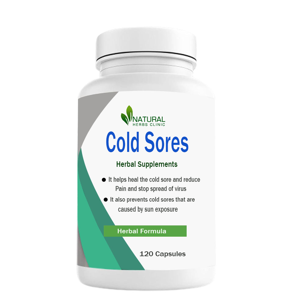 Herbal Treatment for Cold Sores | Natural Herbs Clinic
