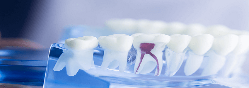Visit Emergency Dental Clinic Donvale Right Now for Faster Relief