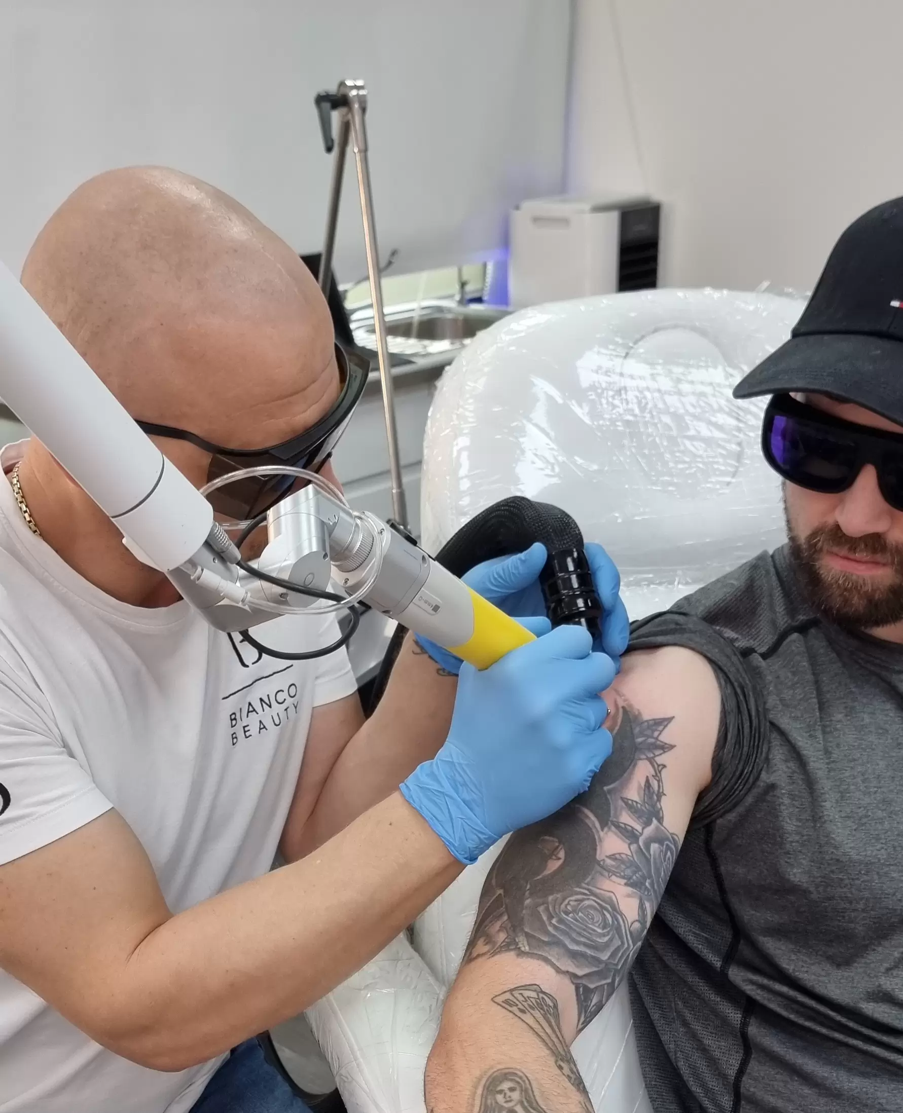 How Much Does Tattoo Removal Cost in London? Price Breakdown