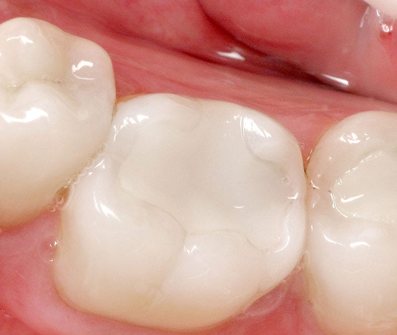 Macduff Dentist Guide: Family Dental Care, Fillings & Veneers